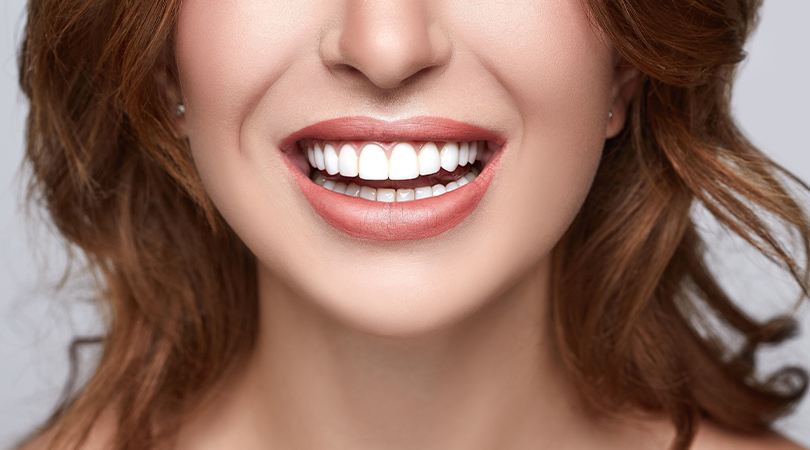 Hollywood Smile ( Gülüş Tasarımı )